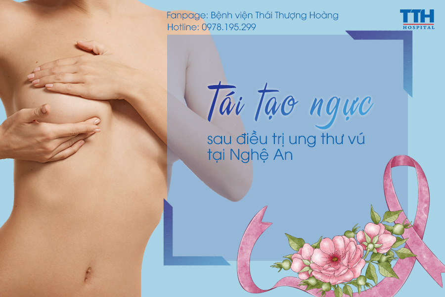 Tái tạo ngực sau ung thư vú tại Nghệ An
